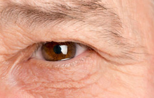 eldery's-eye-2 Close-up image of an elderly person’s eye showing age-related changes