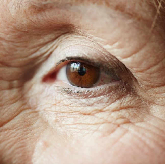 elderly eye